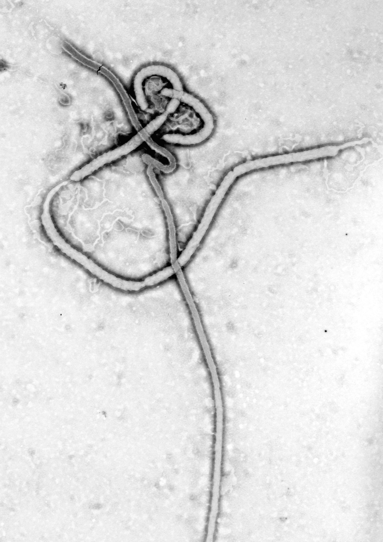 Elektronenmikroskopische Aufnahme eines Ebolavirus-Partikels, CDC 1976.