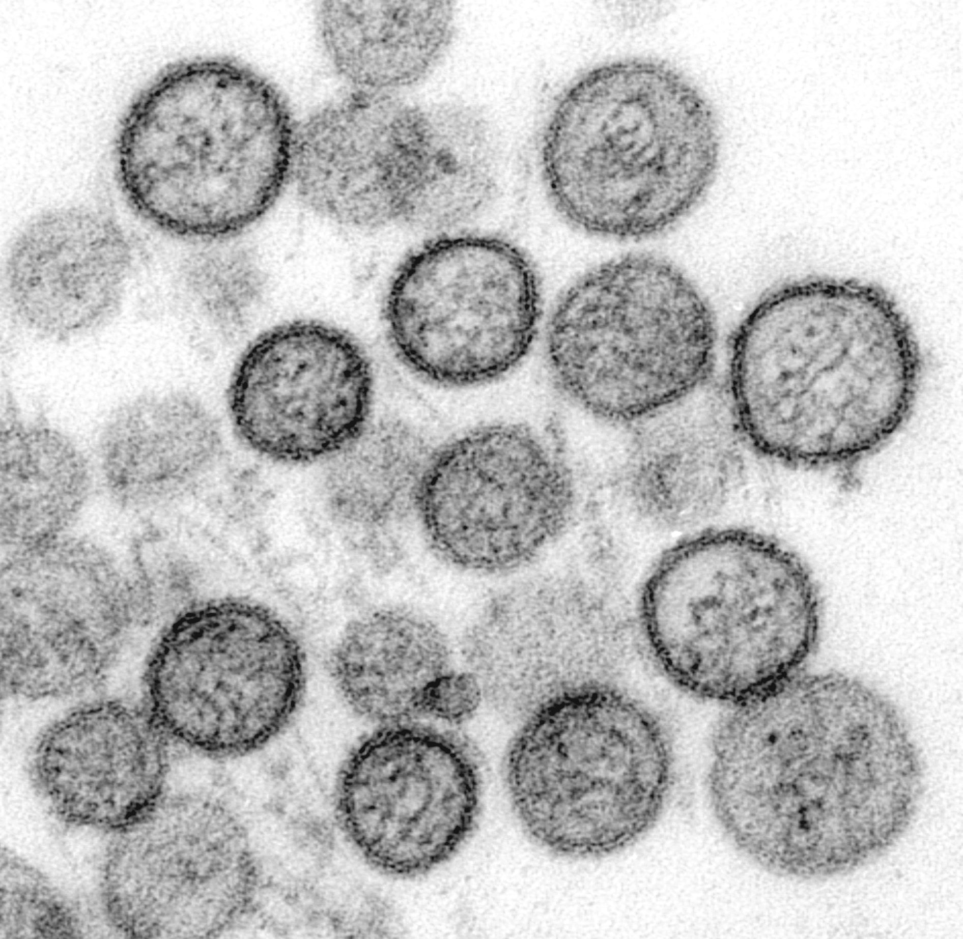 Elektronenmikroskopische Aufnahme des Sin-Nombre-Virus aus der Familie der Hantaviren